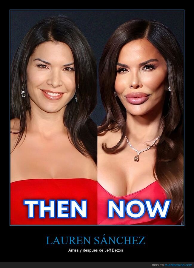 antes,después,lauren sánchez