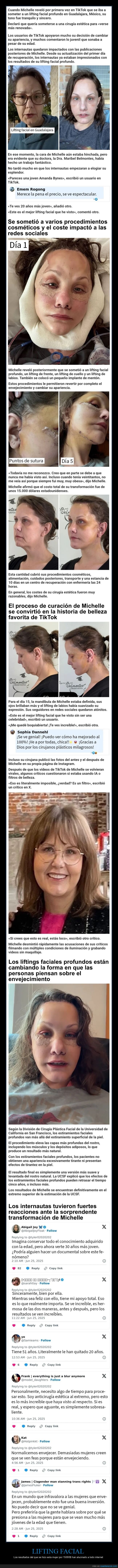 lifting facial,antes,después