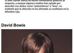 Enlace a Celebridades con peculiaridades corporales que quizá no habías notado