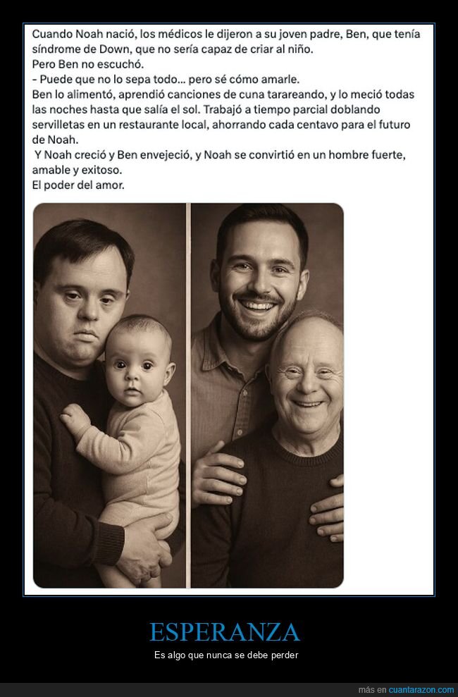 sindrome de down,padre,hijo