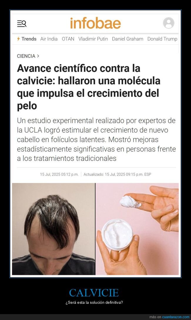 calvicie,pelo,crecepelo