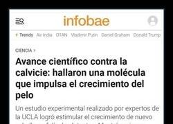 Enlace a Buena noticia para los calvos