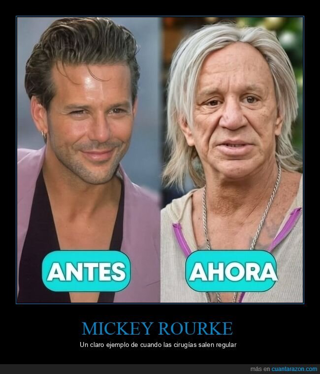 mickey rourke,antes,ahora