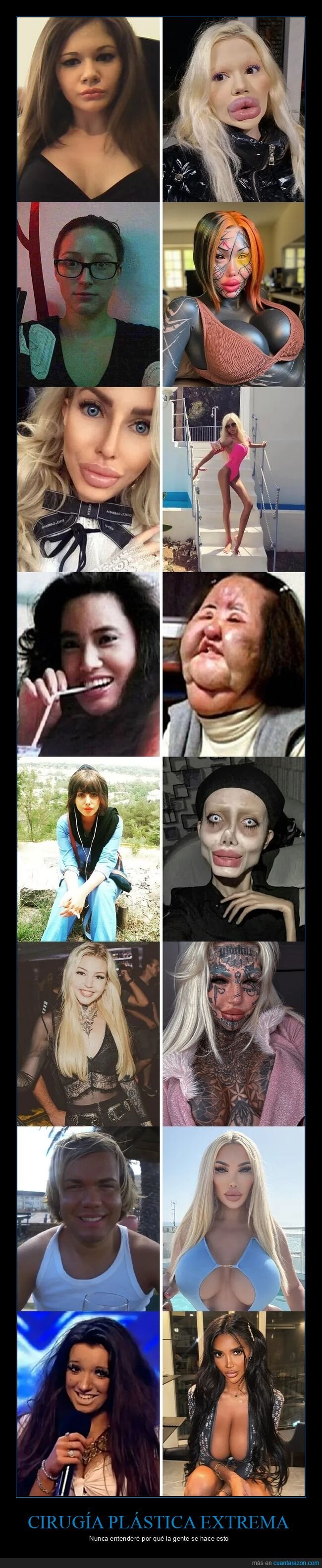 cirugía,plática,estética,desastre