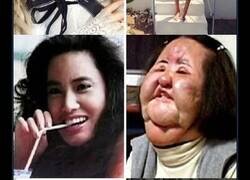 Enlace a Vidas comunes arruinadas por cirugías plásticas extremas