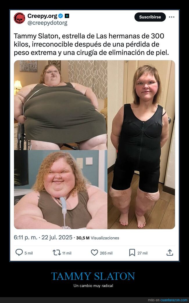 antes,después,las hermanas de 300 kilos,tammy slaton