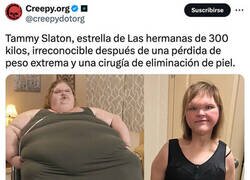 Enlace a Adelgazamiento extremo