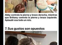 Enlace a Increíbles situaciones por las que han tenido que pasar las siamesas más famosas del mundo