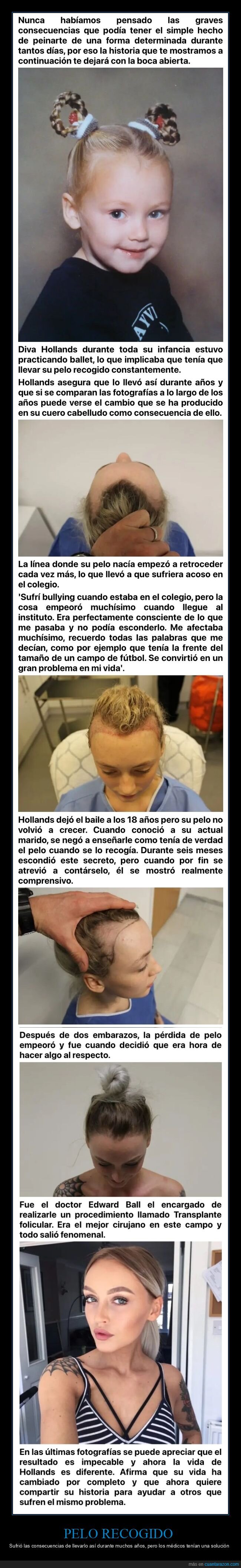 pelo,recogido,trasplante folicular