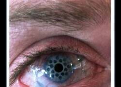 Enlace a Fotos médicas que demuestran que el cuerpo es a veces aterrador