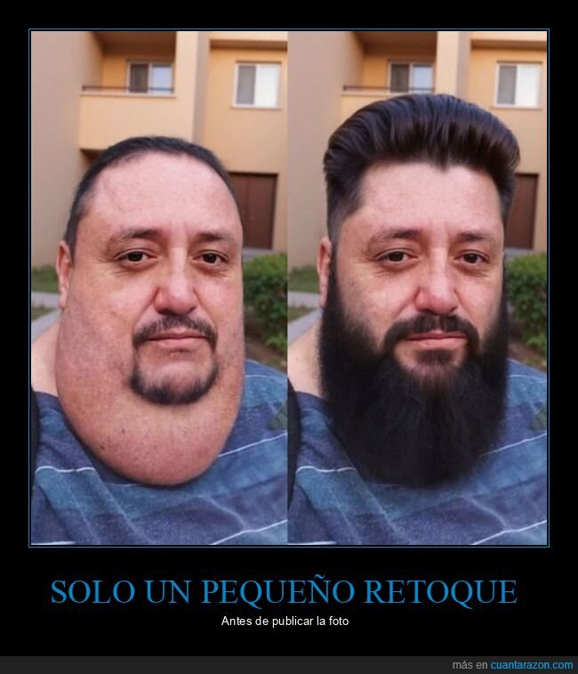 barba,papada,retoque