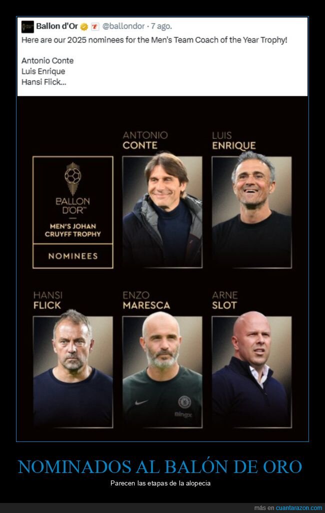 nominados,balón de oro,etapas,alopecia,fútbol