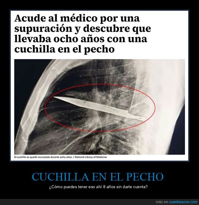cuchillo,médico,pecho,wtf