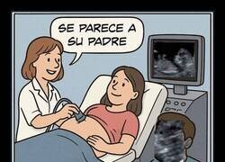 Enlace a Ecografía reveladora