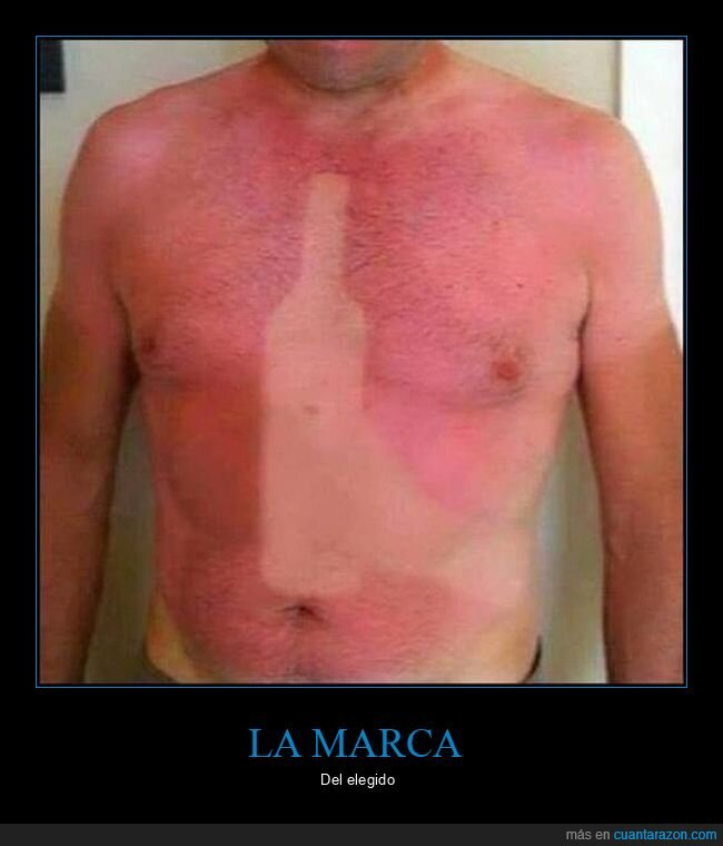 botella,fails,marca,quemado