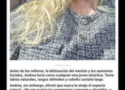Enlace a La mujer con los «labios más grandes del mundo» comparte cómo se veía antes de gastarse $26000 en cirugías extremas