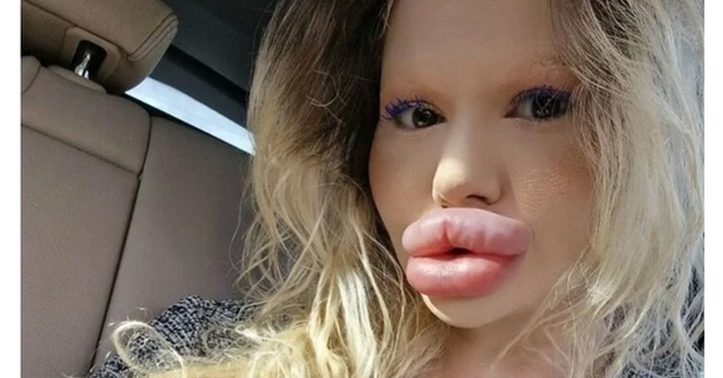 ¡Cuánta razón! / La mujer con los «labios más grandes del mundo ...