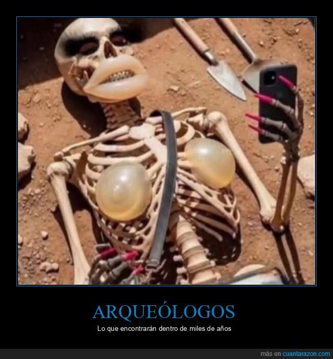 arqueólogos,implantes