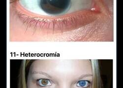 Enlace a Personas que han compartido las partes de su cuerpo más extrañas en Internet