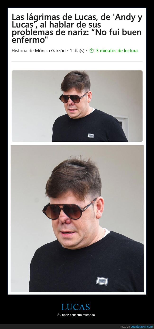 andy y lucas,nariz