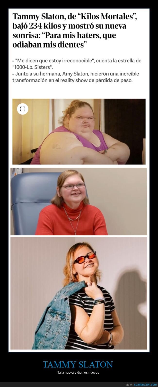 antes,después,dientes,las hermanas de 300 kilos,tammy slaton