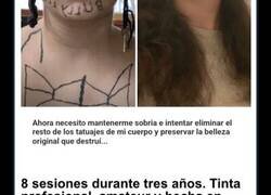 Enlace a Fotos del antes y después de borrarse un tatuaje