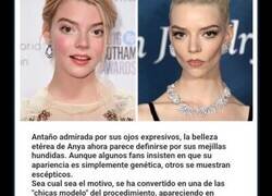 Enlace a Celebridades que posiblemente arruinaron su belleza tras someterse al procedimiento de eliminación de grasa bucal