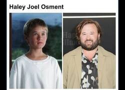 Enlace a Estrellas que apenas se parecen a sí mismas después de sus transformaciones asombrosas