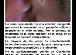 Enlace a Mutaciones genéticas poco comunes que sólo algunas personas pueden tener