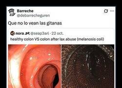 Enlace a Las consecuencias de abusar de los laxantes