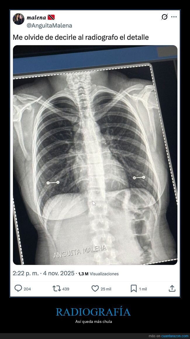 piercings,radiografía