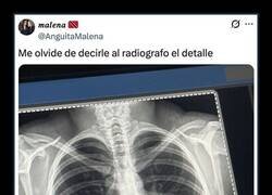 Enlace a Descuido en la radiografía
