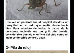 Enlace a Cosas de infarto que los médicos han llegado a sacar de los oídos de sus pacientes