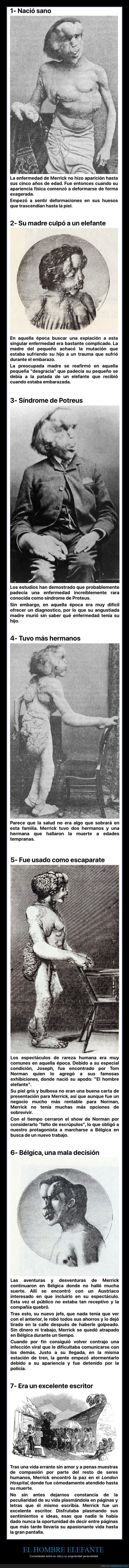 el hombre elefante,joseph merrick