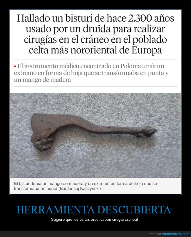 herramienta,bisturí,cirugías,celtas