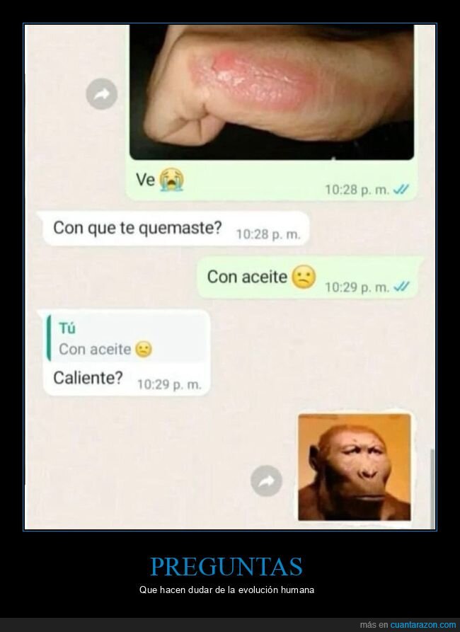 aceite,caliente,quemarse