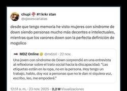 Enlace a Mujeres con Síndrome de Down VS Hombres con Síndrome de Down