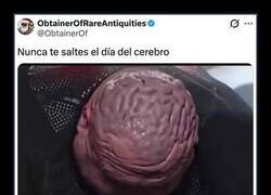 Enlace a Hipertrofia cerebral