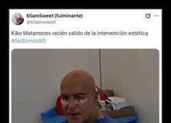 Enlace a ¿Otra cirugía?