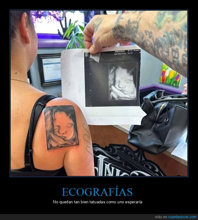 ecografía,tattoo