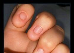 Enlace a Lo que sea menos eso...