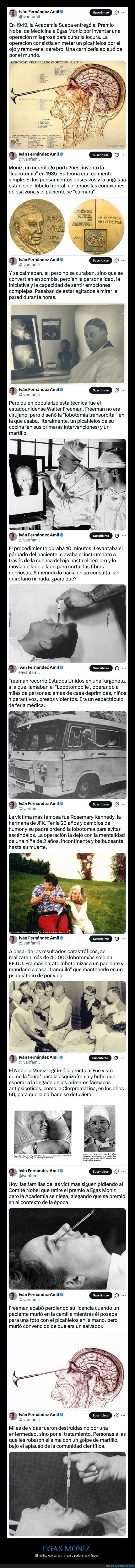 egas moniz,lobotom&iacute;as