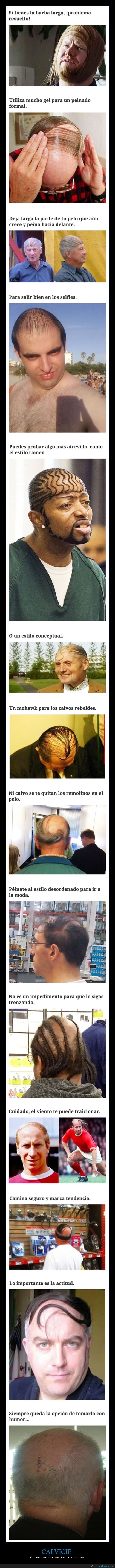 calvicie,calvos,ocultar,pelo