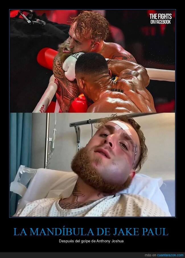 mand&iacute;bula,jake paul,anthony joshua,boxeo
