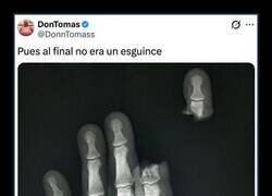 Enlace a Radiografía reveladora