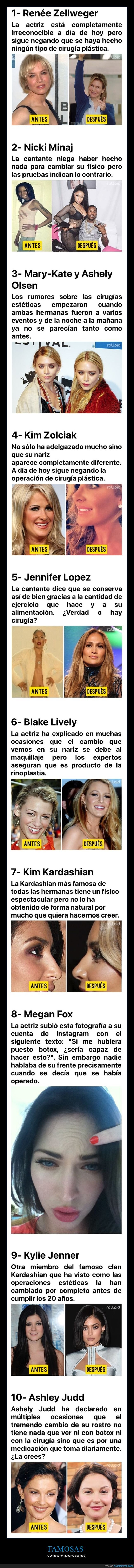 famosas,negar,cirug&iacute;as