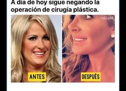 Enlace a Famosas que negaron haberse operado