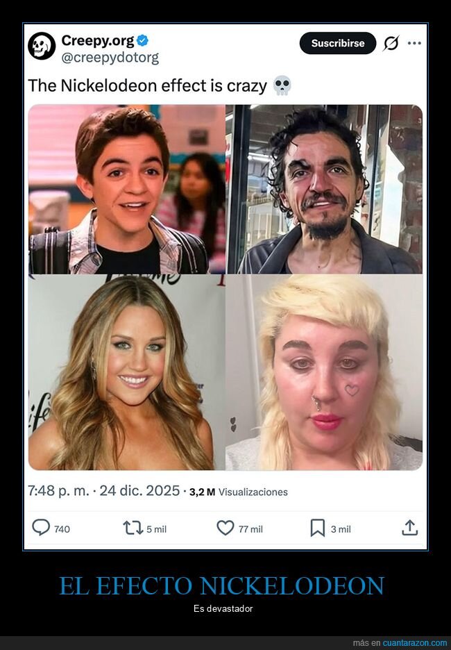 antes,despu&eacute;s,nickelodeon