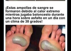 Enlace a Casos médicos fascinantes cuyas imágenes no puede soportar cualquiera