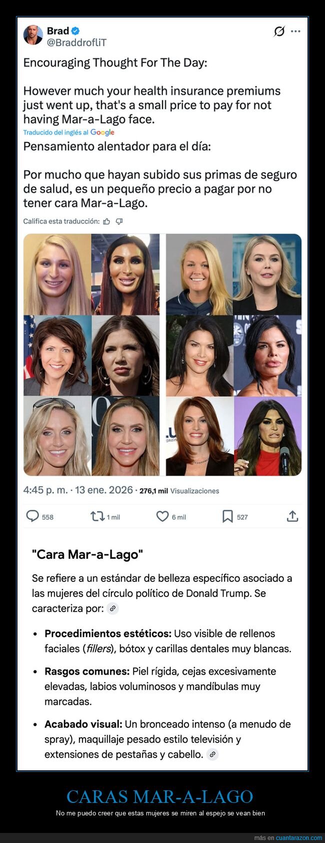 caras mar-a-lago,cirug&iacute;as